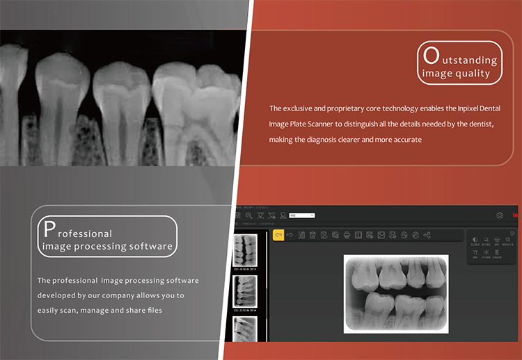 XR6S1 Image Plate Scanner